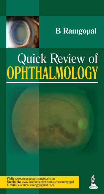 Quick Review Of Ophthalmology