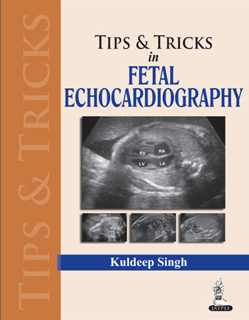 Tips & Trics In Fetal Echocardiography
