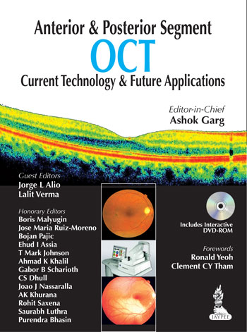 Anterior & Posterior Segment Oct Current Technology & Future Applications With Dvd-Rom