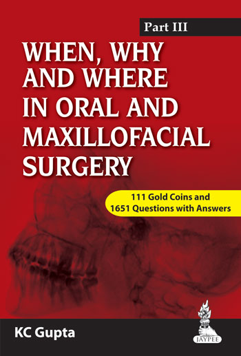 When,Why And Where In Oral And Maxillofacial Surgery Part Iii