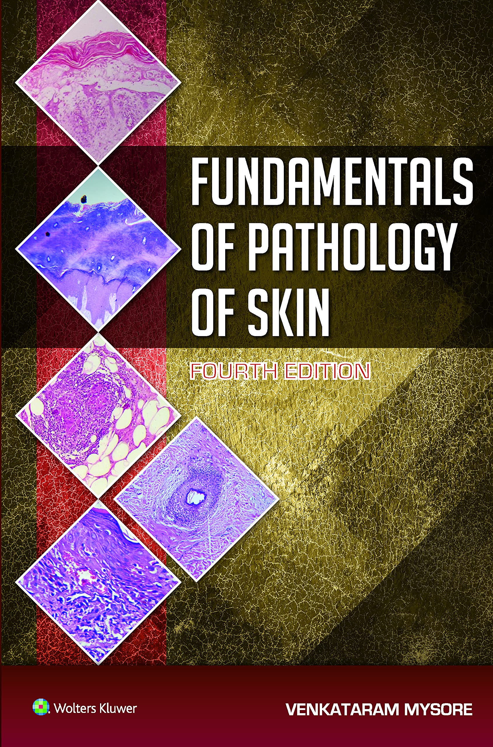 Fundamentals Of Pathology Of Skin 4/E