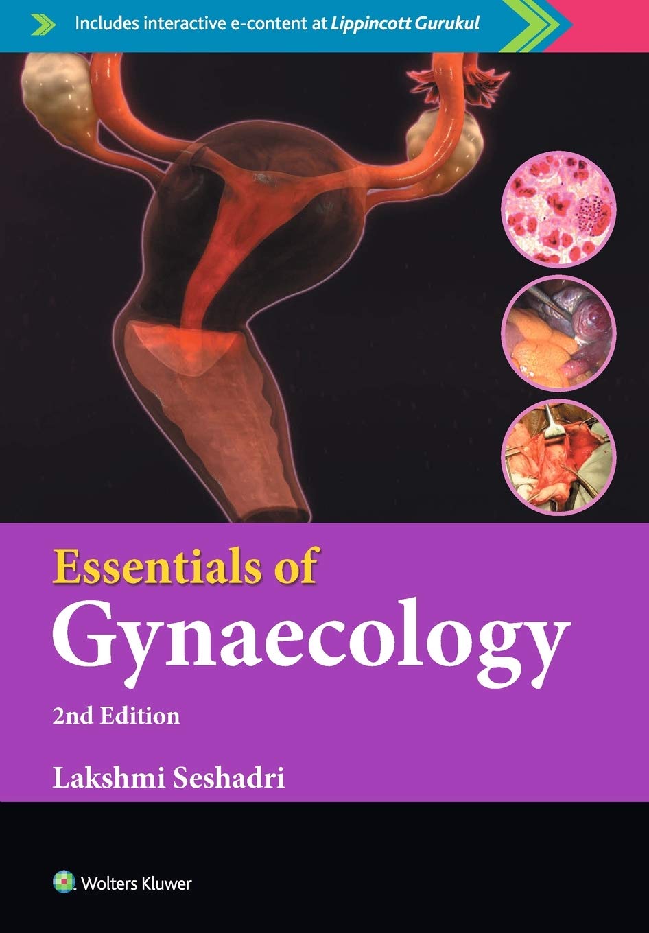 Essentials Of Gynaecology, 2/E