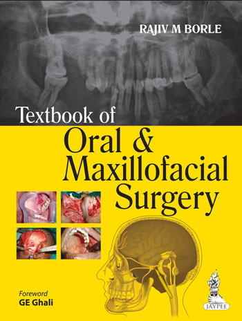 Textbook Of Oral & Maxillofacial Surgery