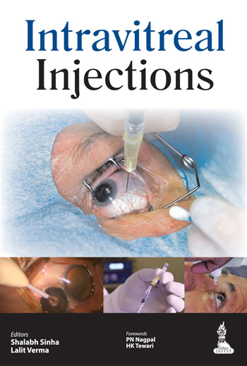 Intravitreal Injections