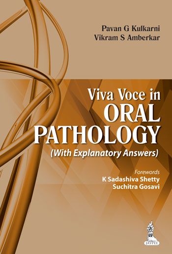 Viva Voce In Oral Pathology (With Explanatory Answers)