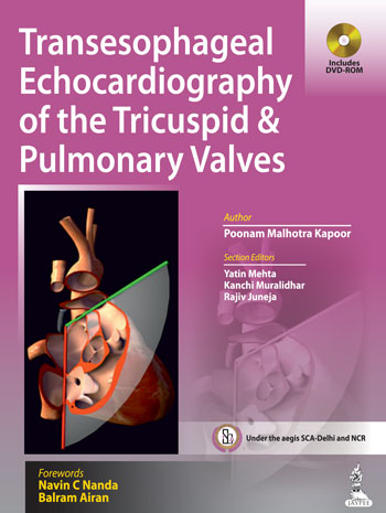 Transesophageal Echocardiography Of The Tricuspid & Pulmonary Valves  Includes Dvd-Rom
