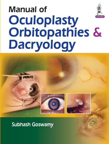 Manual Of Oculoplasty, Orbitopathies & Dacryology