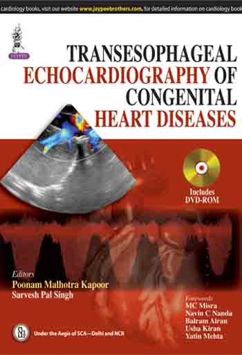 Transesophageal Echocardiography Of Congenital Heart Diseases