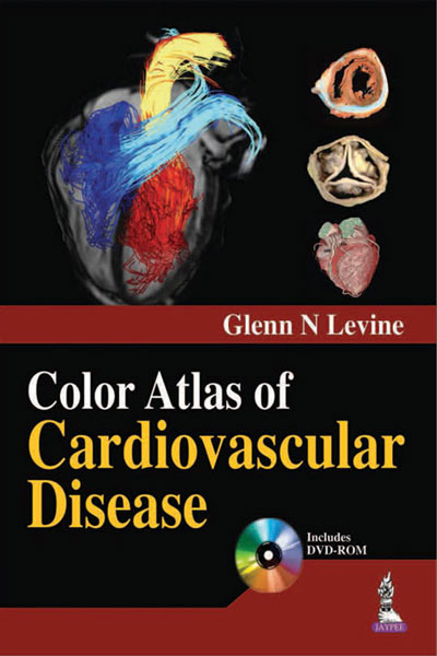 Color Atlas Of Cardiovascular Disease With Dvd-Rom