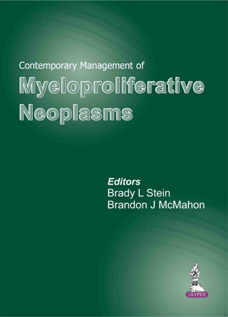 Contemporary Management Of Myeloproliferative Neoplasms