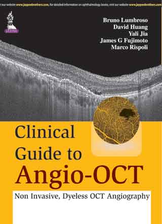 Clinical Guide To Angio-Oct: Non Invasive,Dyeless Oct Angiography