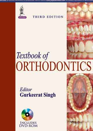 Textbook Of Orthodontics