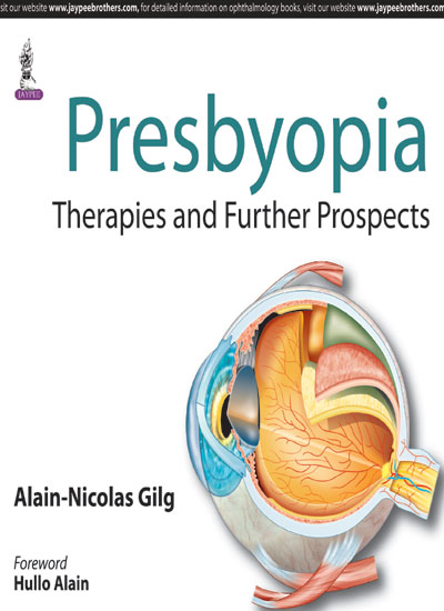 Presbyopia:Therapies And Further Prospects