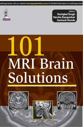 101 Mri Brain Solutions