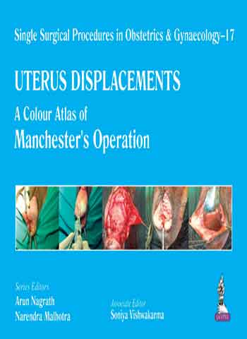 Single Surgical Procedures In Obstetrics & Gynaecology-17: Uterus-Displacements