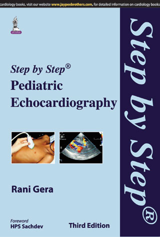 Step By Step Pediatric Echocardiography