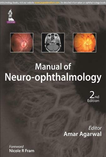 Manual Of Neuro-Ophthalmology