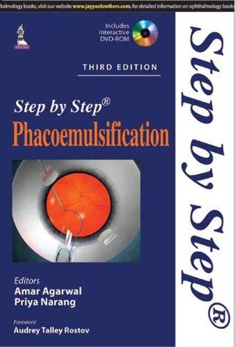 Step By Step Phacoemulsification With Dvd-Rom