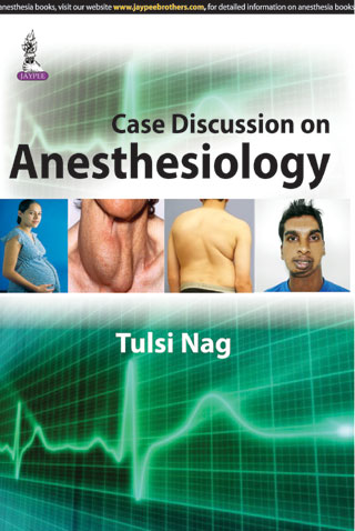 Case Discussion On Anesthesiology