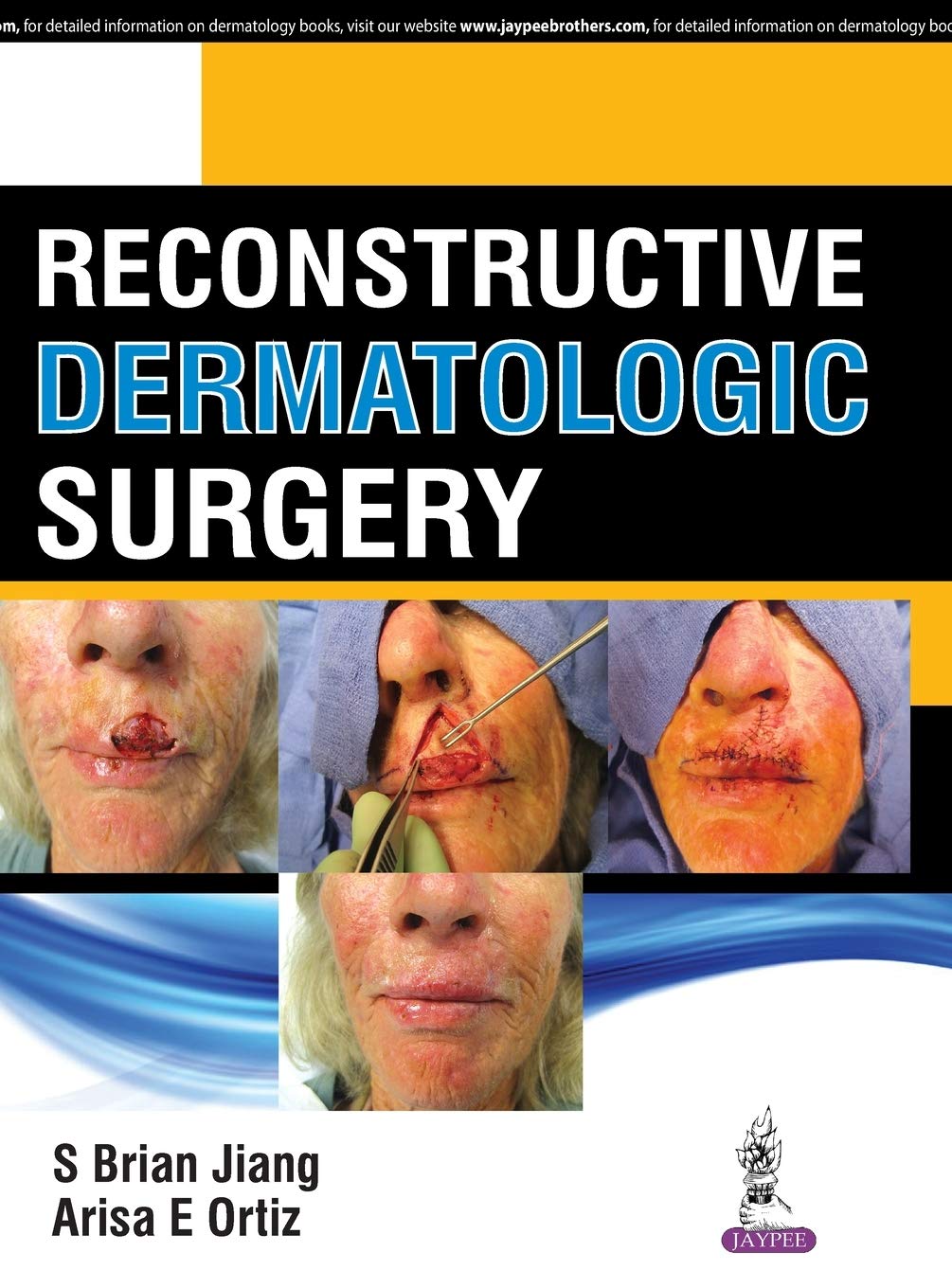 Reconstructive Dermatologic Surgery