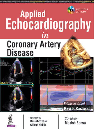 Applied Echocardiography In Coronary Artery Disease Includes Cd-Rom