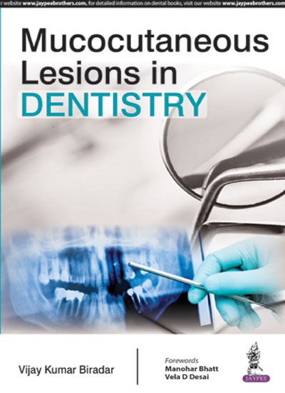 Mucocutaneous Lesions In Dentistry