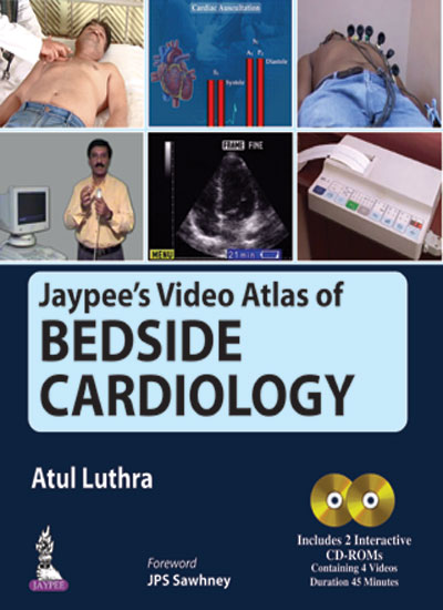 Jaypee'S Video Atlas Of Bedside Cardiology Includes 2 Interactive Cd-Roms