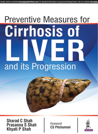 Preventive Measures For Cirrhosis Of Liver And Its Progression