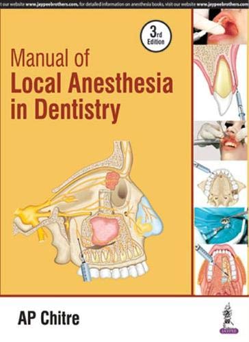 Manual Of Local Anesthesia In Dentistry