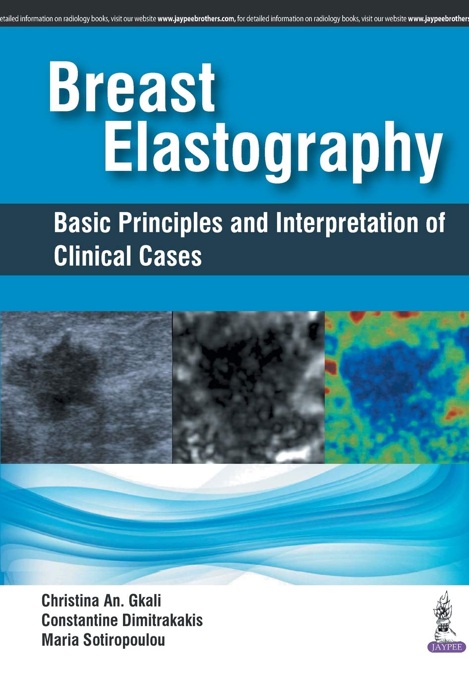 Breast Elastography Basic Principles And Interpretation Of Clinical Cases