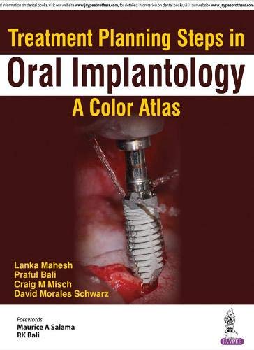 Treatment Planning Steps In Oral Implantology:A Color Atlas