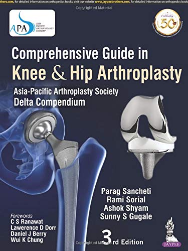 Comprehensive Guide In Knee & Hip Arthroplasty Asia-Pacific Arthroplasty Society Delta Compendium