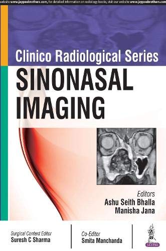 Clinico Radioloical Series:Sinonasal Imaging