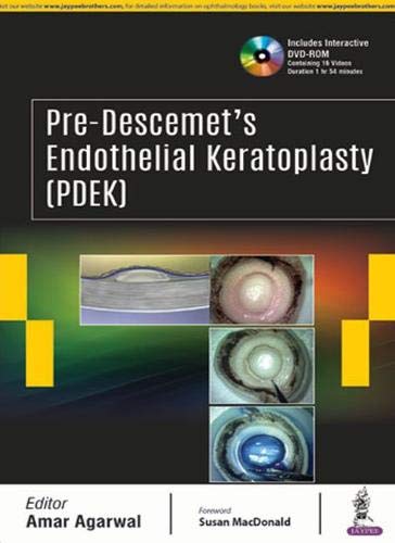 Pre-Descemet'S Endothelial Keratoplasty(Pdek)