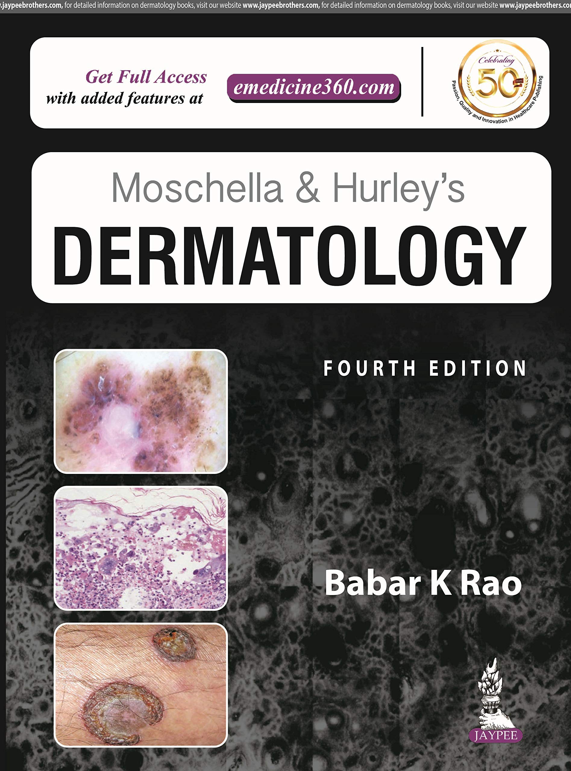 Moschella And Hurley'S Dermatology (2 Vols.)