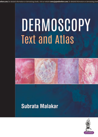 Dermoscopy Text And Atlas