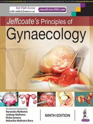 Jeffcoate'S Principles Of Gynaecology