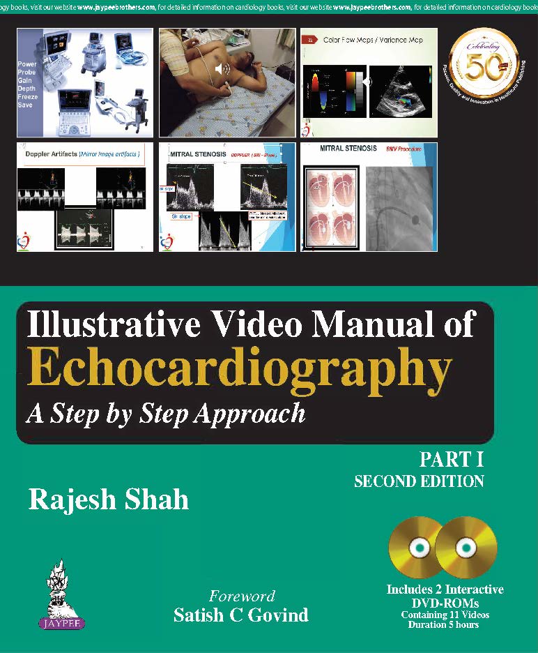 Illustrative Video Manual Of Echocardiography A Step By Step Approach Part 1