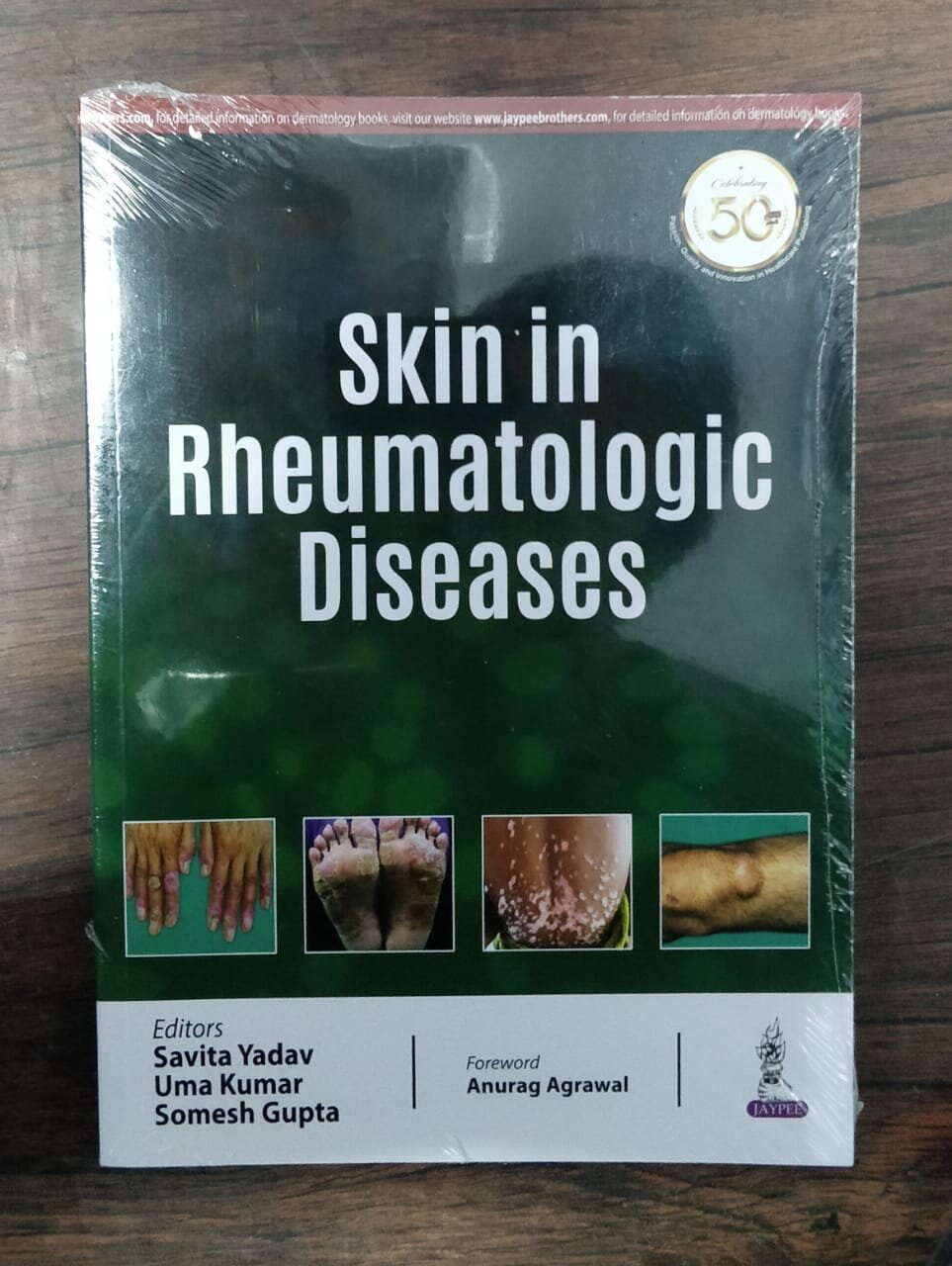 Skin Rheumatologic Diseases