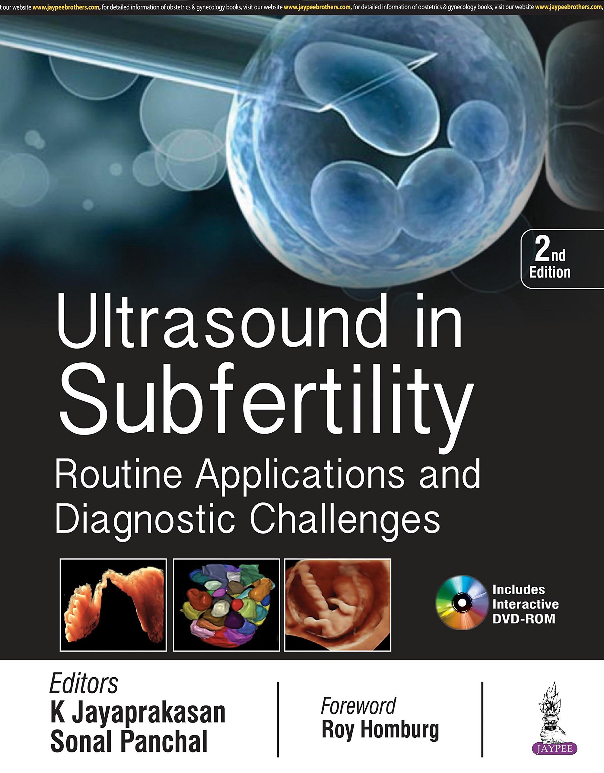 Ultrasound In Subfertility Routine Application