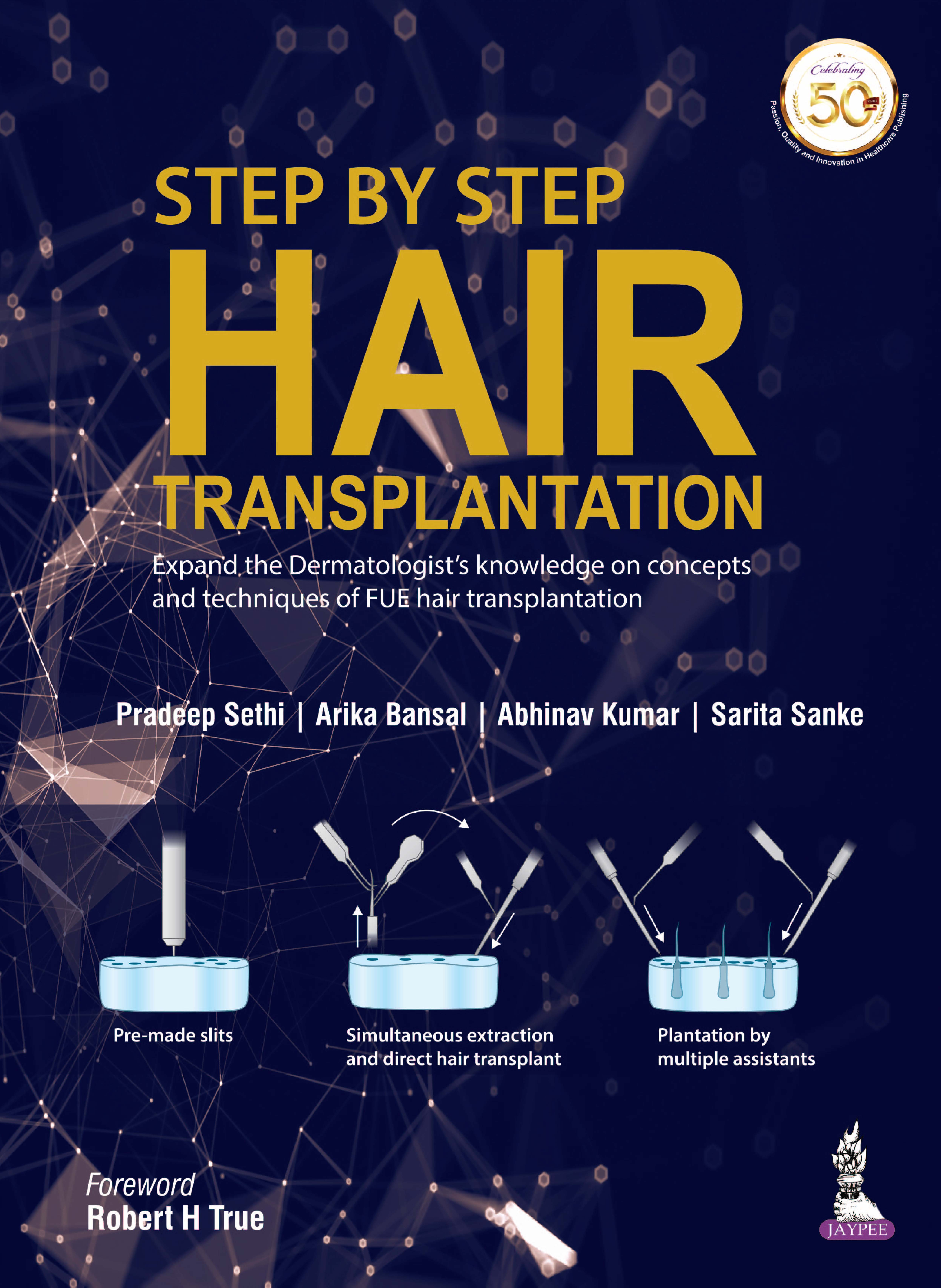 Step By Step Hair Transplantation
