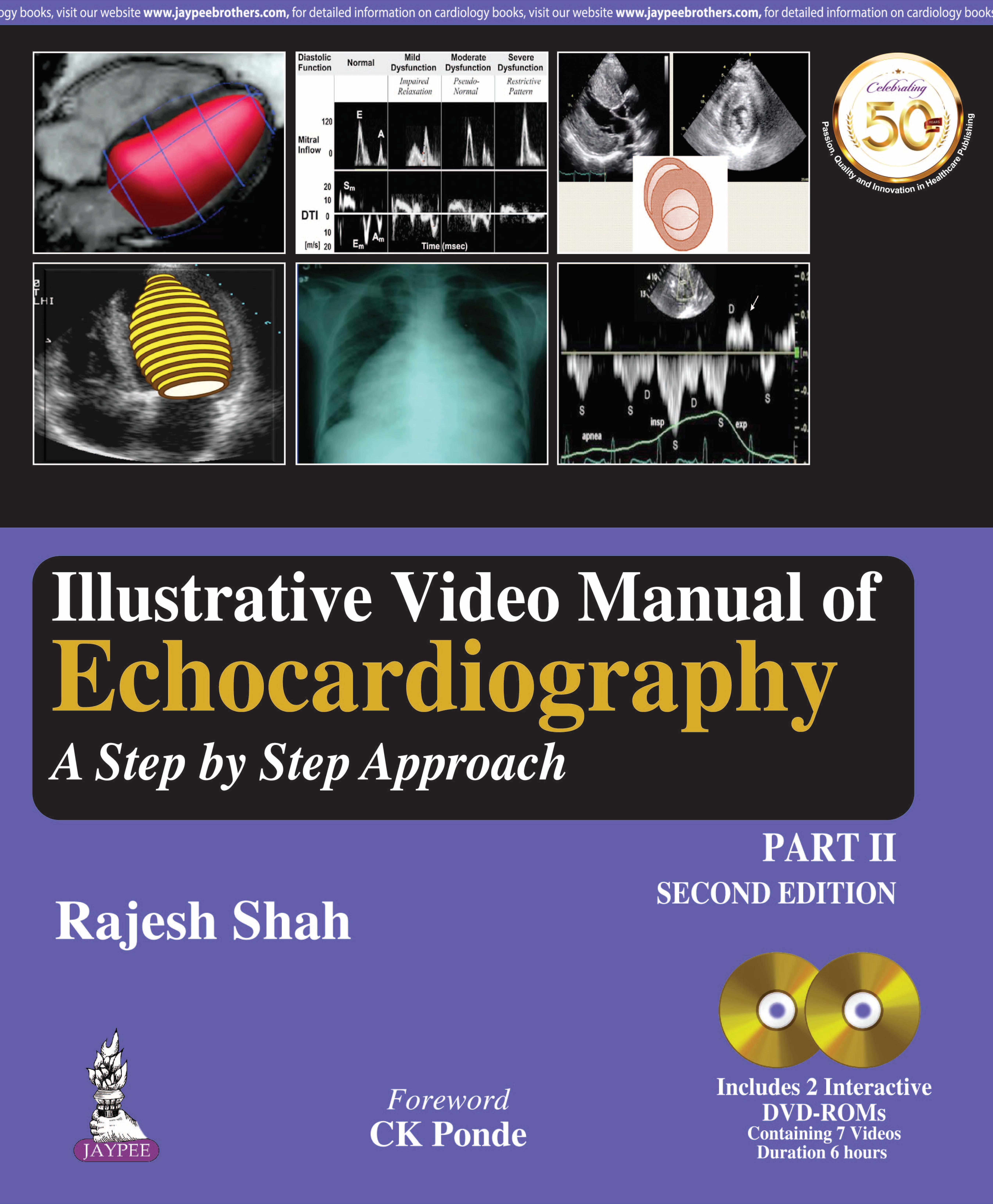 Illustrative Video Manual Of Echocardiography A Step By Step Approach Part Ii Includes 2 Dvd-