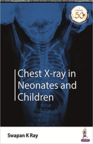 Chest X-Ray In Neonates And Children