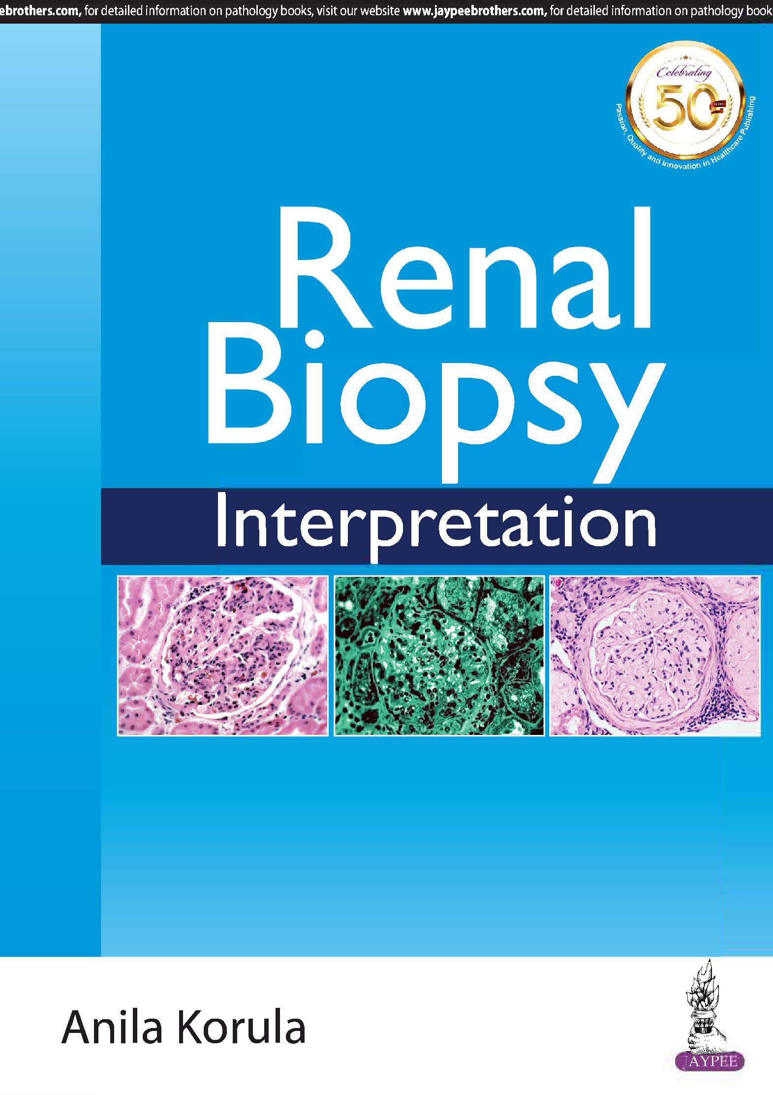 Renal Biopsy Interpretation