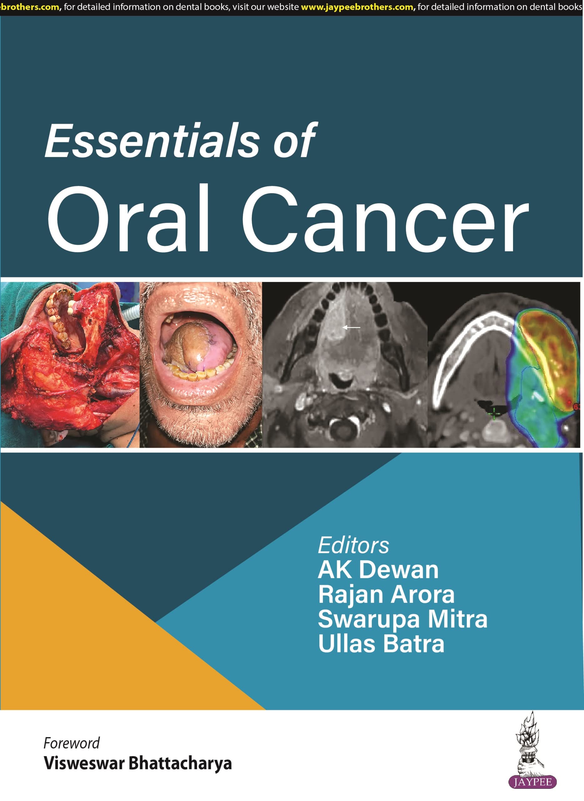 Essentials Of Oral Cancer
