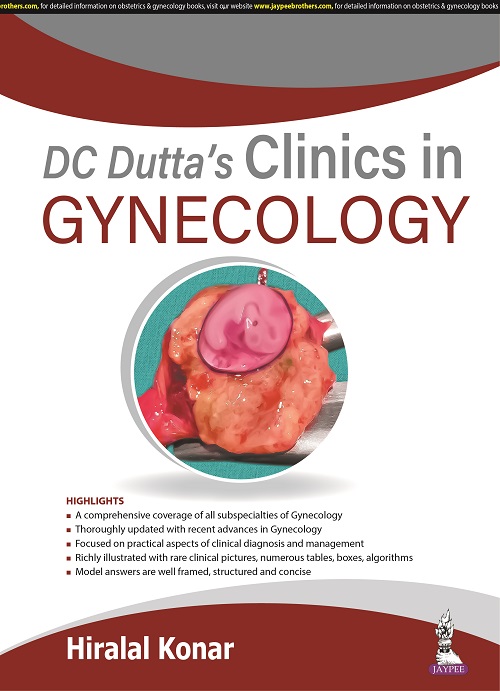 Dc Dutta’S Clinics Of Gynecology -1/E-2022