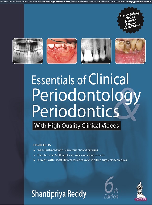 Essentials Of Clinical Periodontology Periodontics With High Quality Clinical Video 6/E