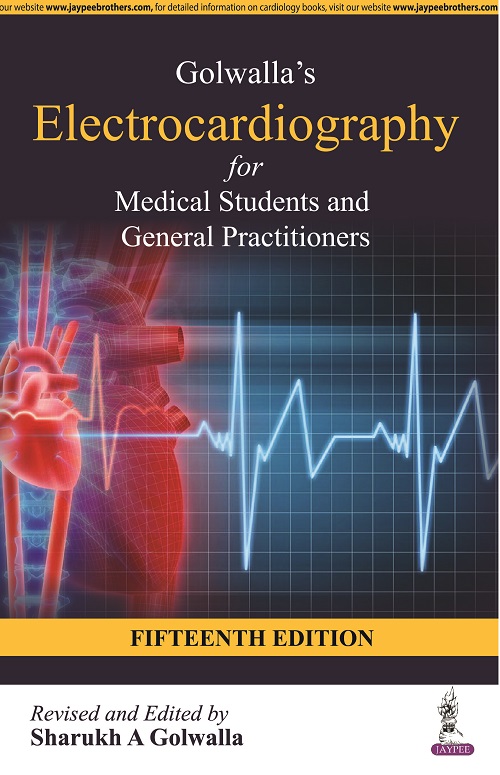 Golawalla'S Electrocardiography For Medical Students And General Practitioners