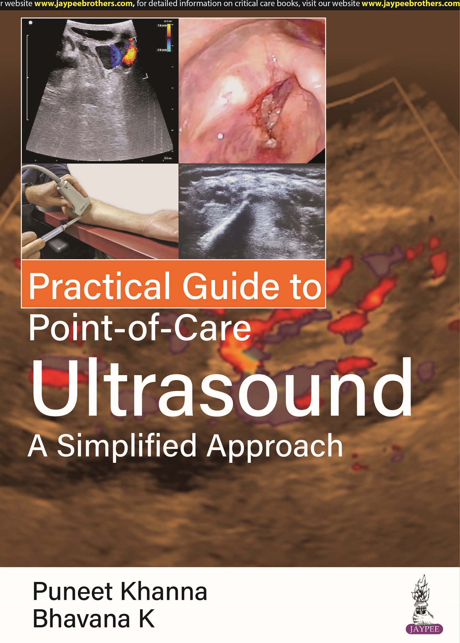 Practical Guide to Point-of-Care Ultrasound: A Simplified Approach