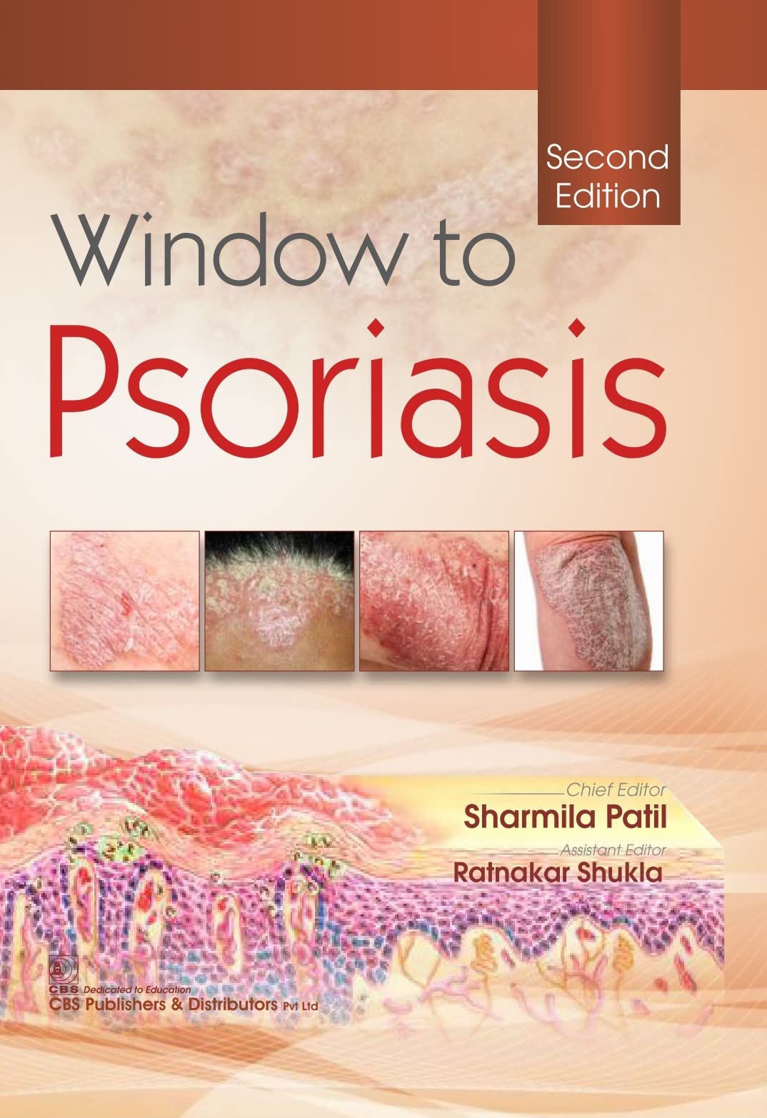 Window To Psoriasis, 2/E